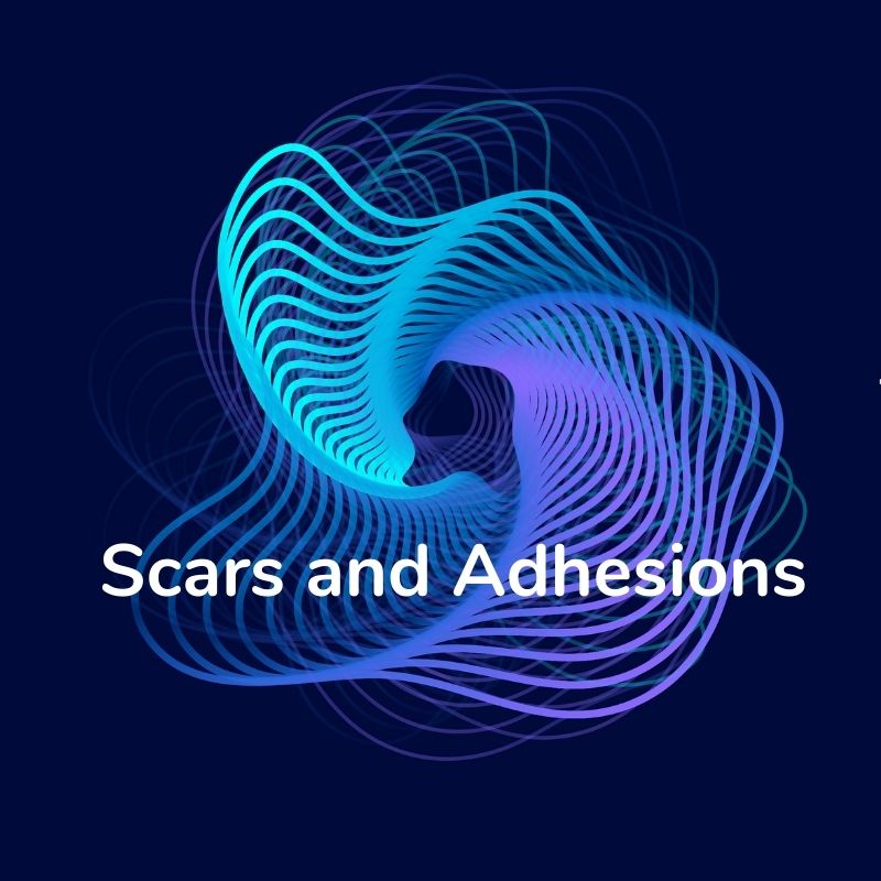 Category image for content related to scars and adhesions