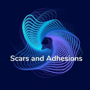 Category image for content related to scars and adhesions